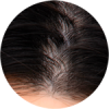 人間髪植毛（Silicone Head Hair2）